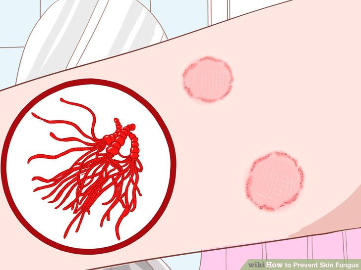 Prevent Skin Fungus Step 7 Version 2.jpg