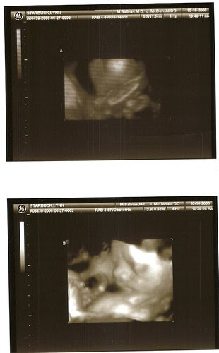 scan