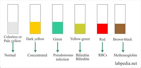  view 13 jaundice stool color chart adults pic nugget urine color