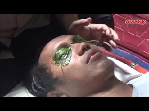 Video Kesehatan Mata