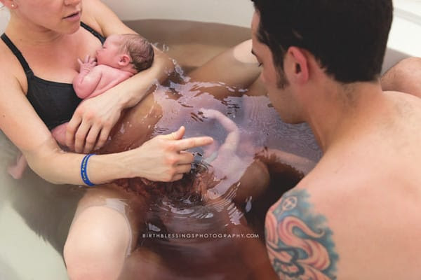 Couple Expected That Their Twins Will Be Normal. But When The Second Baby Was Born They Shock!