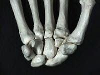 Anterior palmar view. 
