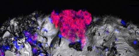 common bacterium   discovered thriving   place