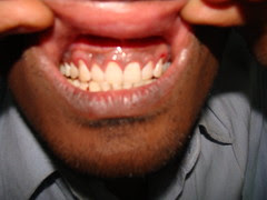 DSC02695