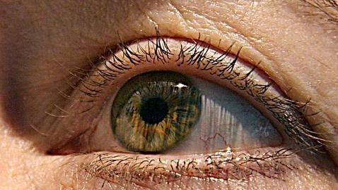 Glaucoma: el ladrón silencioso de la visión