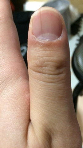 新しいコレクション 爪 黒い線 子供 見て面白い壁紙のウェブサイト