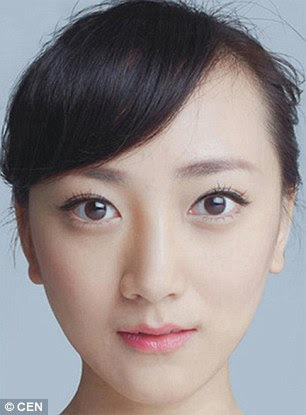 Liu Yi, a 25-year-old office manager for real estate sales, after surgery
