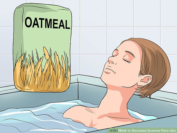 Decrease Eczema Flare Ups Step 14 Version 2.jpg