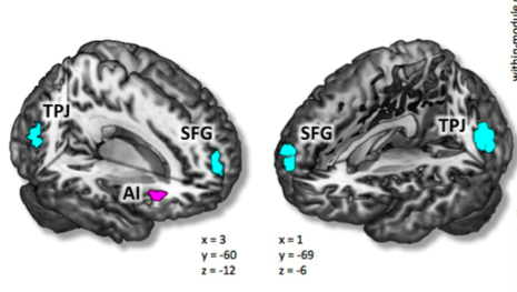 18~60세 남녀 309명의 fMRI 데이터를 분석한 결과 지능이 높은 사람들은 앞뇌섬엽(AI)의 모듈 간 네트워크가 활발한 반면 상전두회(SFG)와 측두-두정 연접부(TPJ)의 모듈 간 네트워크는 오히려 약한 것으로 드러났다. - 사이언티픽 리포트 제공