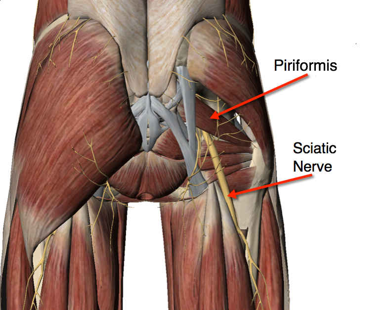 Is It Sciatica Or Piriformis Syndrome Jonas