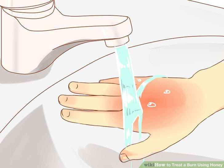 Treat a Burn Using Honey Step 4 Version 3.jpg