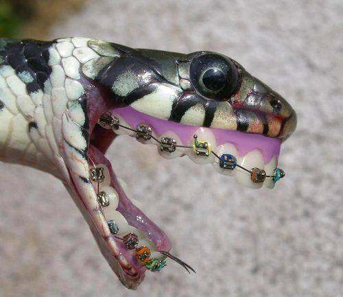snake braces