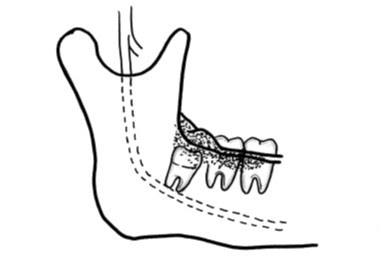 診療実績 対象疾患 歯科口腔外科 札幌市の総合病院 手稲渓仁会病院