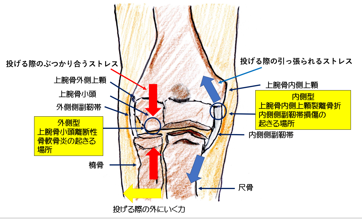 ボールが投げられない 肘が曲げ伸ばし出来ない 野球肘でお悩みの方必見 すみだ整骨院 直方 飯塚 田川 八幡で整骨院なら