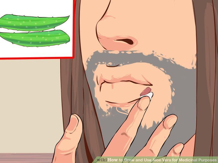 Grow and Use Aloe Vera for Medicinal Purposes Step 10 Version 2.jpg
