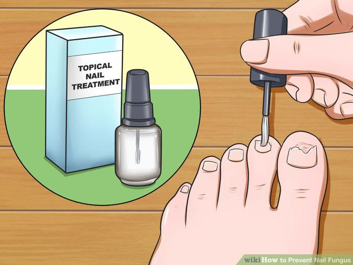 Prevent Nail Fungus Step 11.jpg