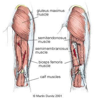 hamstring