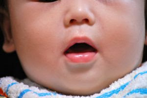 顎 アゴ 顔 カオ 成長不全 常滑市 歯科 小児歯科 矯正歯科 は中村歯科医院