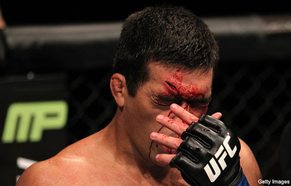 UFC 140 postfight: Bonuses, Lesnar-Overeem rumors and flyweight division debuts on Mar. 3