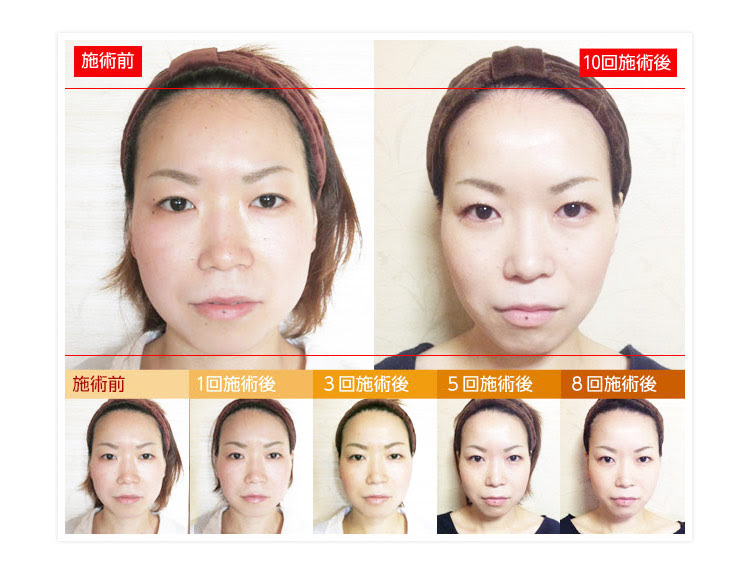 女性モニター様 比較写真 小顔整体研究所 Ksラボ