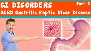 Gastritis vs. GERD vs. Peptic Ulcer *Part 5*. Видео из ...
