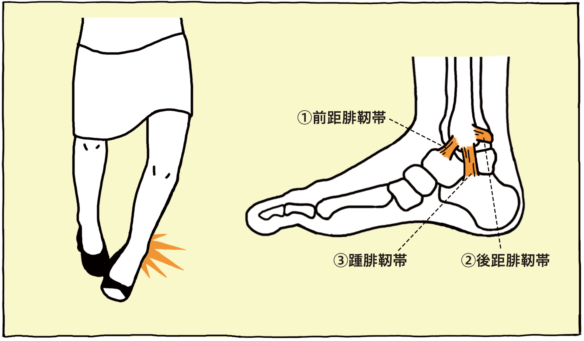 足首が痛い 原因 と 場所 から分類 解説 対処法 足のお悩み百科