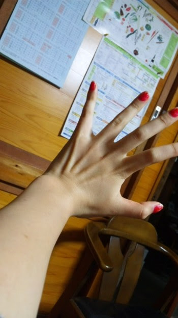 手の筋って気持ち悪い 指も痩せたのかな 写真共有サイト フォト蔵