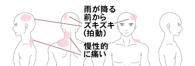 頭痛 症例 腰痛 肩こり 頭痛等の改善なら みずほ整体院 熊本市東区