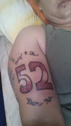 11+ Tattoo Removal Cost PNG