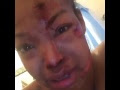 Lady Gets Beating Of Life As Present From Her Boyfriend On Her 24th Birthday