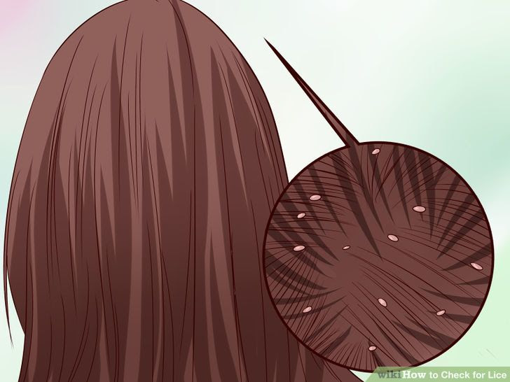 Check for Lice Step 8 Version 2.jpg