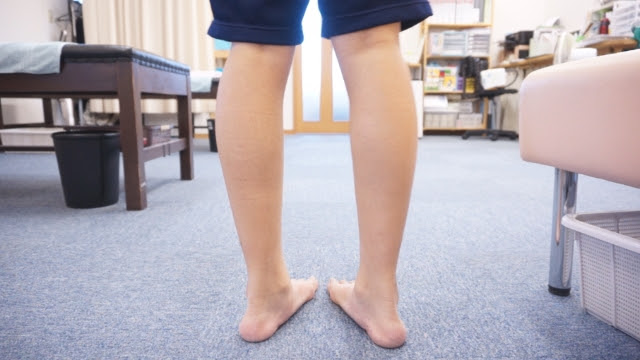 捻挫の 捻 は ひねる って読みます 足部の歪みで内またになった四日市市内女子中学生 剣道部