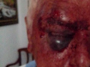 Idoso teve hematomas no rosto (Foto: Polícia Militar/Divulgação)