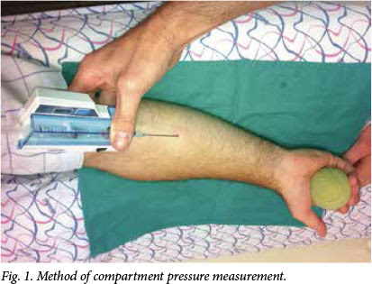 Chronic Exertional Compartment Syndrome In The Forearm Of A Rower
