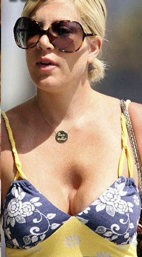 shannen doherty plastic surgery pictures