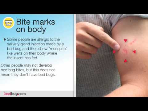 Bed Bug Command Overview For Households How To Know If You Have Bed Bugs