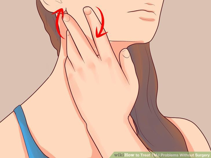 Treat TMJ Problems Without Surgery Step 9.jpg