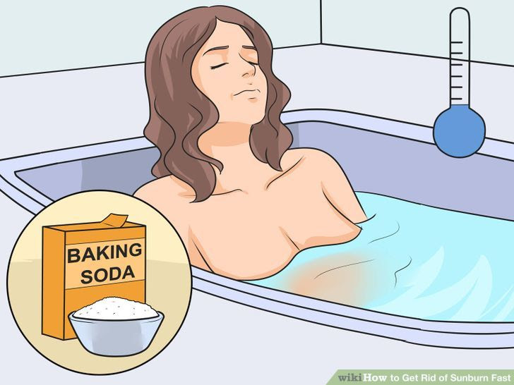 Get Rid of Sunburn Fast Step 11 Version 2.jpg