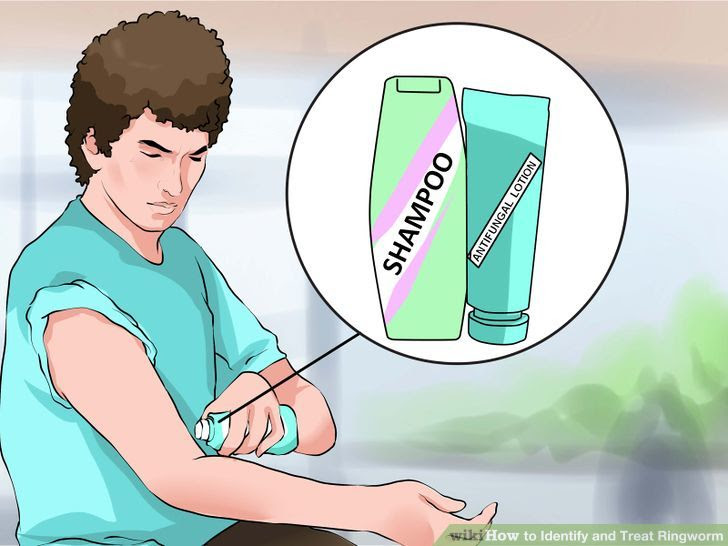 Identify and Treat Ringworm Step 17.jpg