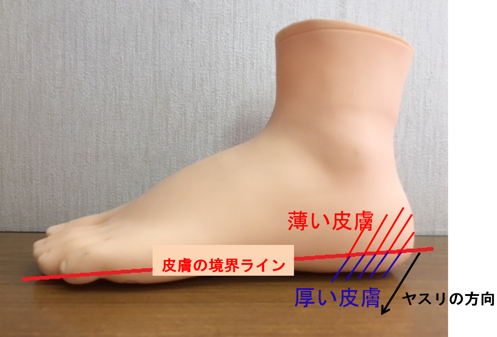 踵のセルフケア 一般社団法人 足の番人 公式 足の知識 活動報告