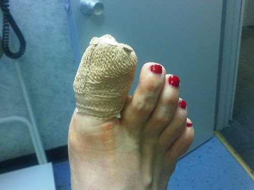Had unexpected toe surgery today. Owie!