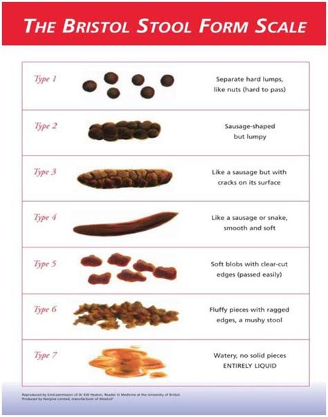  click on image to zoom bristol stool bowel movement chart bristol