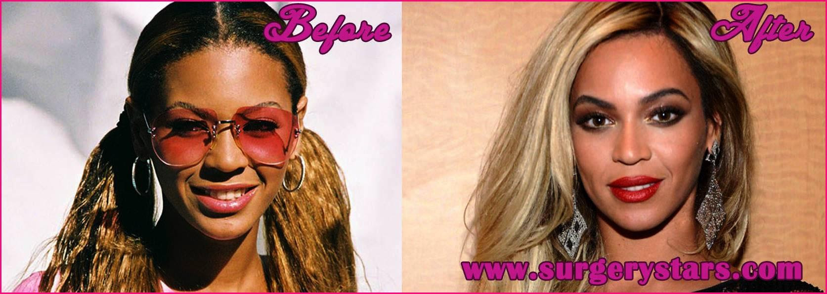 beyonce before after nose 