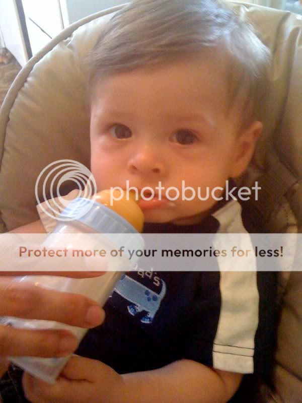 Why Does My LO Have Bags Under His Eyes? - BabyCenter