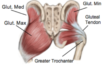 Gluteal Tendinopathy - physioFIX