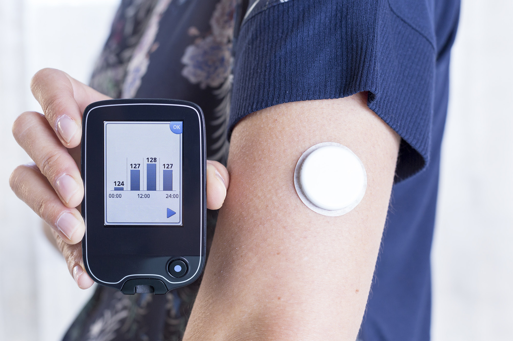 What Is a Continuous Glucose Monitoring Device and Can