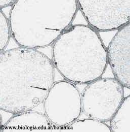 Parénquima  medular de raíz de Zea mays