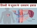 Woman Spleen Meaning In Hindi