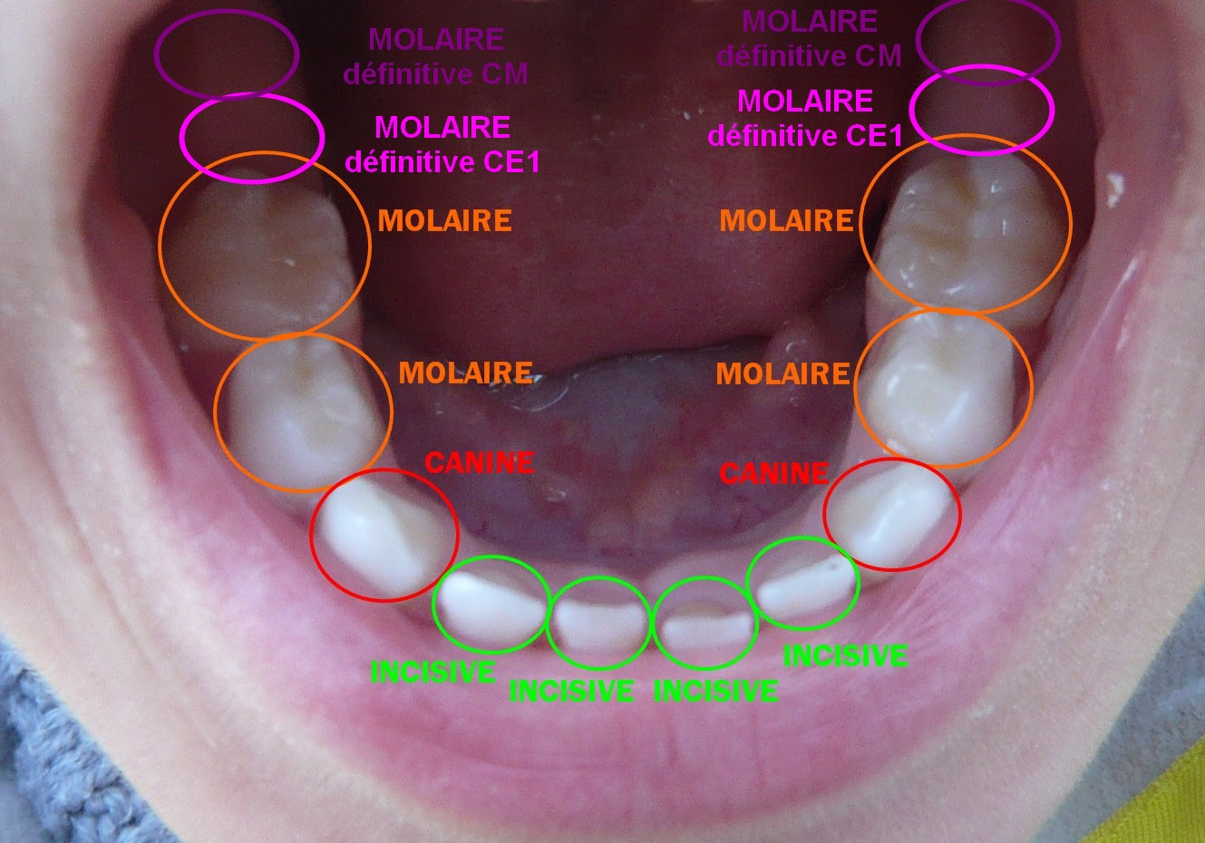 Les Dents La Classe De Noemi