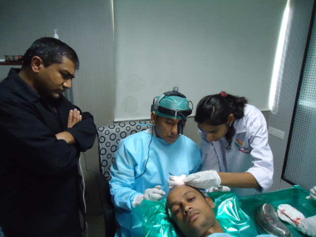 Hair Transplant Delhi NCR